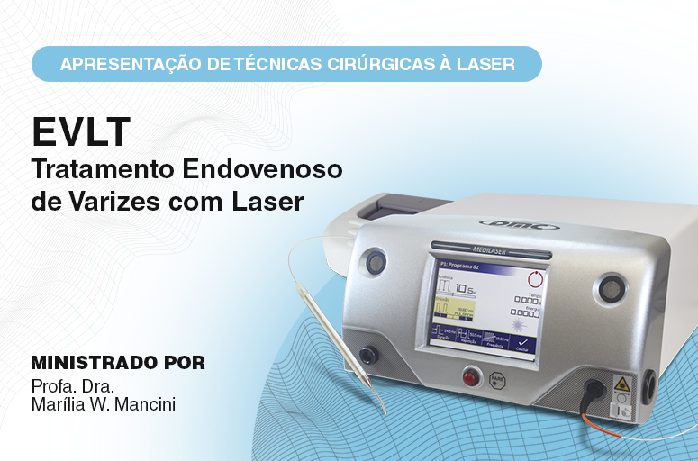 Tira Dúvidas - Apresentação do Tratamento Endovenoso de Varizes a Laser - EVLT